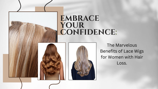Embrace Your Confidence: The Marvelous Benefits of Lace Wigs for Women with Hair Loss